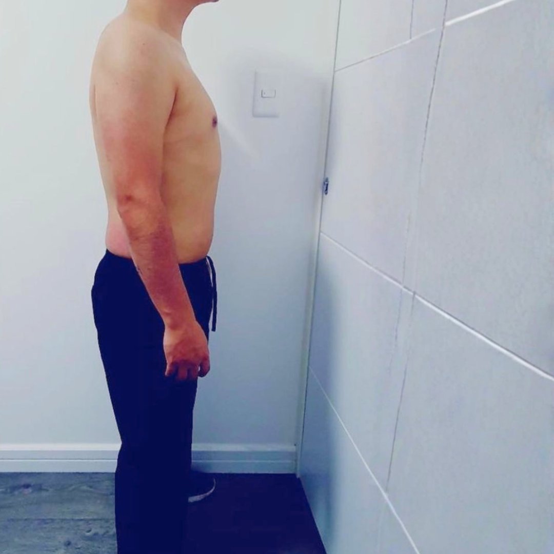 Shirtless man showing sunburned back and shoulders, standing in profile indoors